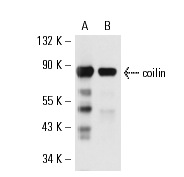  coilin (H1): sc-53979. Western blot analysis of coilin expression in XLK-WG (A) and A6 (B) whole cell lysates.