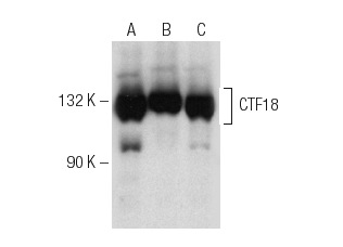  CTF18 (F-1): sc-374632. Western blot analysis of CTF18 expression in HEL 92.1.7 (A), K-562 (B) and SH-SY5Y (C) nuclear extracts.