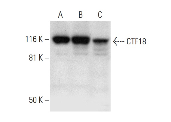  CTF18 (B-7): sc-376074. Western blot analysis of CTF18 expression in HEL 92.1.7 (A), K-562 (B) and SH-SY5Y (C) nuclear extracts.