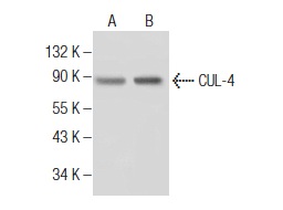  CUL-4 (H-11): sc-sc-377188. Western blot analysis of CUL-4 expression in SK-MEL-28 (A) and A-375 (B) whole cell lysates.