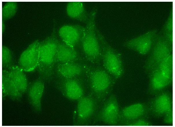  CUL-4 (H-66): sc-10782. Immunofluorescence staining of formalin-fixed HeLa cells showing nuclear and cytoplasmic localization. Kindly provided by Yang Xiang, Ph.D., Division of Newborn Medicine, Boston Childrens Hospital, Cell Biology Department, Harvard Medical School.z