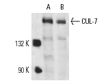  CUL-7 (AB13): sc-53809. Western blot analysis of CUL-7 expression in U-2 OS (A) and T98G (B) whole cell lysates.