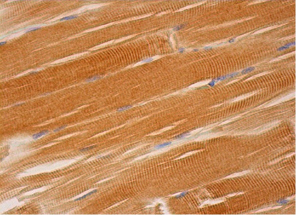  CUL-7 (AB38): sc-53810. Immunoperoxidase staining of formalin fixed, paraffin-embedded human skeletal muscle tissue showing cytoplasmic staining of myocytes.