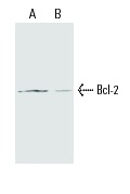  Bcl-2 (10C4): sc-23960. Western blot analysis of Bcl-2 expression in murine thymocytes (A) and rat H9c2 cardiomyoblasts (B). Kindly provided by Dr. Yi-Te Hsu at the NIH.