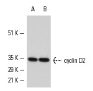  cyclin D2 (M-20): sc-593. Western blot analysis of cyclin D2 expression in MM-142 nuclear extract (A,B).