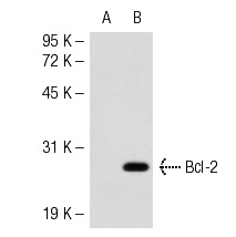  Bcl-2 (YTH10C4): sc-81002. Western blot analysis of Bcl-2 expression in non-transfected: sc-117752 (A) and mouse Bcl-2 transfected: sc-118779 (B) 293T whole cell lysates.