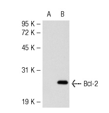  Bcl-2 (5K140): sc-70411. Western blot analysis of Bcl-2 expression in non-transfected: sc-117752 (A) and mouse Bcl-2 transfected: sc-118779 (B) 293T whole cell lysates.