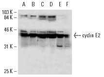  cyclin E2 (A-9): sc-28351. Western blot analysis of cyclin E2 expression in F9 (A), HeLa (B), Saos-2 (C) and MDA-M-468 (D) whole cell lysates and Jurkat (E) and IMR-32 (F) nuclear extracts.