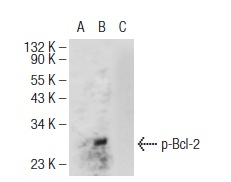  p-Bcl-2 (74.Ser 70): sc-135757. Western blot analysis of Bcl-2 phosphorylation in untreated (A), paclitaxel treated (B) and paclitaxel and lambda protein phosphatase treated (C) Jurkat whole cell lysates.