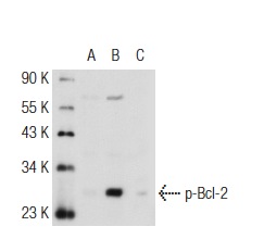  p-Bcl-2 (74.Ser 70): sc-135757. Western blot analysis of Bcl-2 phosphorylation in untreated (A), paclitaxel treated (B) and paclitaxel and lambda protein phosphatase treated (C) Jurkat whole cell lysates. 