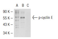  p-cyclin E (Thr 395)-R: sc-12917-R. Western blot analysis of cyclin E phosphorylation in non-transfected: sc-117752 (A), untreated human cyclin E transfected: sc-170464 (B) and lambda protein phosphatase treated human cyclin E transfected: sc-170464 (C) 293T whole cell lysates.