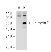  p-cyclin E (Thr 395)-R: sc-12917-R. Western blot analysis of cyclin E phosphorylation in non-transfected: sc-117752 (A) and human cyclin E transfected: sc-170464 (B) 293T whole cell lysates.