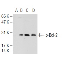  Western blot analysis of Bcl-2 phosphorylation in untreated (A,C), and paclitaxel treated (B,D) Jurkat whole cell lysates. Antibodies tested include p-Bcl-2 (74.Ser 70): sc-135757 (A,B) and Bcl-2 (C-2): sc-7382 (C,D).