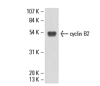  cyclin B2 (X121.10): sc-53239. Western blot analysis of cyclin B2 expression in XLK-WG whole cell lysate.