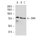  Dbf4 (H-300): sc-11354. Western blot analysis of Dbf4 expression in Sol8 (A), PC-3 (B) and SW480 (C) nuclear extracts.