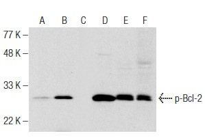  Western blot analysis of Bcl-2 phosphorylation in untreated (A,D), paclitaxel treated (B,E) and paclitaxel and lambda protein phosphatase (sc-200312A) treated (C,F) Jurkat whole cell lysates. Antibodies tested include p-Bcl-2 (367.Ser 70): sc-293128 (A,B,C) and Bcl-2 (C-2): sc-7382 (D,E,F).