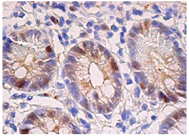  DHFR (E-18): sc-14778. Immunoperoxidase staining of formalin fixed, paraffin-embedded human small intestine tissue showing nuclear staining of subsets of glandular cells.