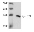  EB3 (K-16): sc-22653. Western blot analysis of EB3 expression in mouse brain tissue extract.