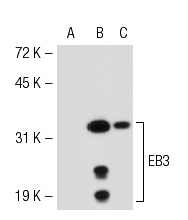  EB3 (K-16): sc-22653. Western blot analysis of EB3 expression in non-transfected: sc-117752 (A) and mouse EB3 transfected: sc-119900 (B) 293T whole cell lysates and mouse brain tissue extract (C).