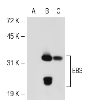  EB3 (T-15): sc-22654. Western blot analysis of EB3 expression in non-transfected: sc-117752 (A) and mouse EB3 transfected: sc-119900 (B) 293T whole cell lysates and mouse brain tissue extract (C).