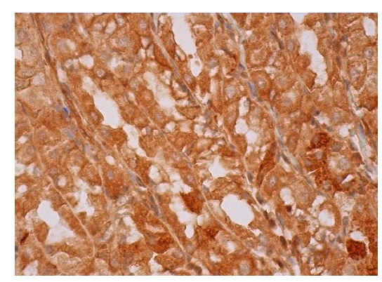  Emi2 (H-62): sc-68894. Immunoperoxidase staining of formalin fixed, paraffin-embedded human upper stomach tissue showing cytoplasmic and nuclear staining of glandular cells.