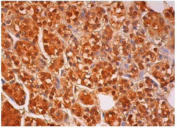  Emi2 (G-20): sc-74918. Immunoperoxidase staining of formalin fixed, paraffin-embedded human parathyroid gland tissue showing nuclear and cytoplasmic staining of glandular cells.