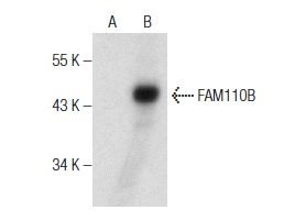  FAM110B (S-18): sc-82141. Western blot analysis of FAM110B expression in non-transfected: sc-117752 (A) and human FAM110B transfected: sc-370926 (B) 293T whole cell lysates.