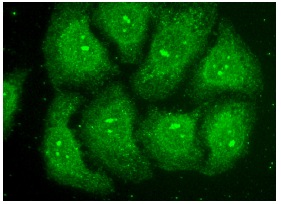  FAM123A (G-1): sc-374654. Immunofluorescence staining of methanol-fixed HeLa cells showing nuclear and cytoplasmic localization.