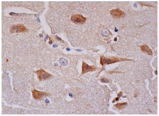  FAM123A (K-15): sc-84112. Immunoperoxidase staining of formalin fixed, paraffin-embedded human cerebral cortex tissue showing cytoplasmic staining of neuronal cells and glial cells.