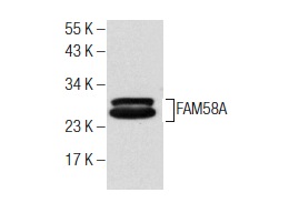  FAM58A (N-13): sc-138781. Western blot analysis of FAM58A expression in mouse eye tissue extract.