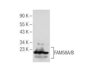  LOC727895 (N-16): sc-84436. Western blot analysis of LOC727895 expression in mouse eye tissue extract.