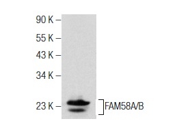  FAM58A/B (N-16): sc-137996. Western blot analysis of FAM58A/B expression in mouse eye tissue extract.