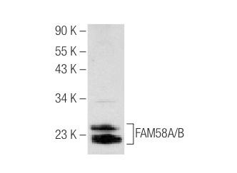  FAM58A/B (S-12): sc-84437. Western blot analysis of FAM58A/B expression in mouse eye tissue extract.