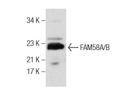  FAM58A/B (S-12): sc-137997. Western blot analysis of FAM58A/B expression in mouse eye tissue extract.