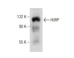  HURP (E-7): sc-377004. Western blot analysis of HURP expression in K-562 whole cell lysate.