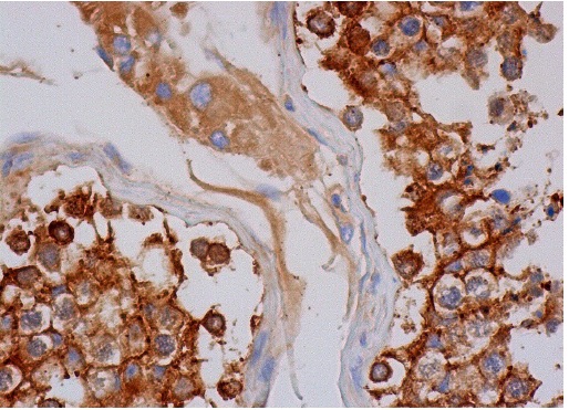  HURP (E-7): sc-377004. Immunoperoxidase staining of formalin fixed, paraffin-embedded human testis tissue showing cytoplasmic and membrane staining of cells in seminiferous ducts and cytoplasmic staining of Leydig cells.