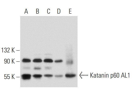  Katanin p60 AL1 (P-20): sc-84324. Western blot analysis of Katanin p60 AL1 expression in HeLa (A), HEK293 (B), Jurkat (C), K-562 (D) and NIH/3T3 (E) whole cell lysates.