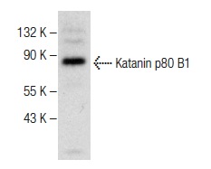  Katanin p80 B1 (H-300): sc-292216. Western blot analysis of Katanin p80 B1 expression in IMR-32 whole cell lysate.