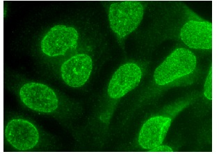  MAD1 (F-7): sc-376613. Immunofluorescence staining of methanol-fixed HeLa cells showing nuclear local-ization.