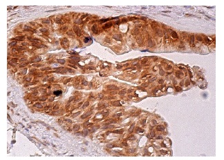  MAD1 (D-1): sc-166312. Immunoperoxidase staining of formalin fixed, paraffin-embedded human gall bladder tissue showing nuclear envelope and cytoplasmic staining of glandular cells.