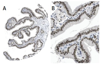  MAD1 (9B10): sc-47746. Immunoperoxidase staining of formalin fixed, paraffin-embedded human gall bladder tissue showing nuclear membrane staining of glandular cells (low and high magnification). Kindly provided by The Swedish Human Protein Atlas (HPA) program.