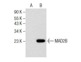  MAD2B (F-12): sc-377367. Western blot analysis of MAD2B expression in non-transfected: sc-110760 (A) and human MAD2B transfected: sc-113252 (B) 293 whole cell lysates.