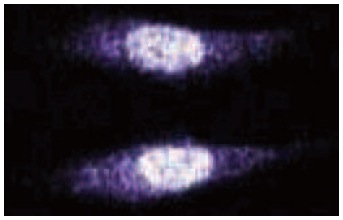  MAD2B (14): sc-135977. Immunofluorescence staining of human endothelial cells showing nuclear and cytoplasmic localization.