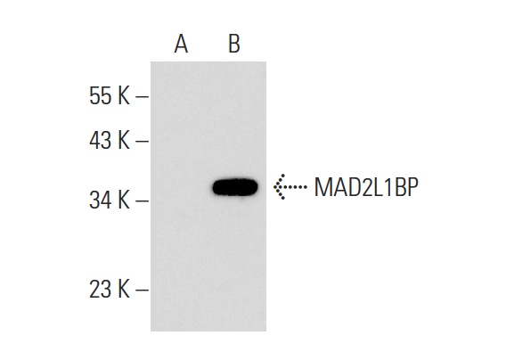  MAD2L1BP (A-15): sc-324098. Western blot analysis of MAD2L1BP expression in non-transfected: sc-117752 (A) and mouse MAD2L1BP transfected: sc-110183 (B) 293T whole cell lysates.