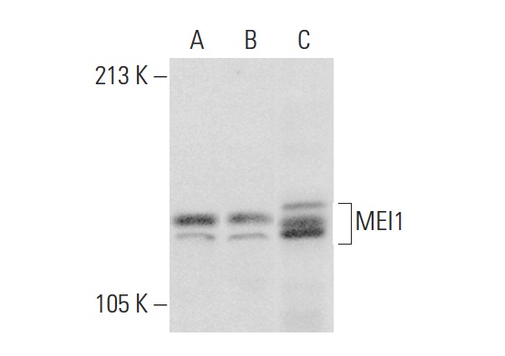  MEI1 (E-19): sc-86732. Western blot analysis of MEI1 expression in HeLa (A) and Jurkat (B) whole cell lysates and rat testis tissue extract (C).