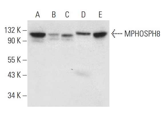  MPHOSPH8 (C-8): sc-398598. Western blot analysis of MPHOSPH8 expression in MIA PaCa-2 (A), HeLa (B), RT-4 (C) and U-251-MG (D) whole cell lysates and HeLa nuclear extract (E).