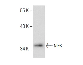  NIFK (T-14): sc-107819. Western blot analysis of NSE1 expression in HeLa whole cell lysate.