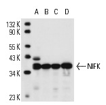  NIFK (18E148): sc-52904. Western blot analysis of NIFK expression in Raji whole cell lysate (A) and BJAB (B), Ramos (C) and HeLa (D) nuclear extracts.