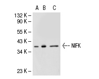  NIFK (18E148): sc-52904. Western blot analysis of NIFK expression in non-transfected 293T: sc-117752 (A), human NIFK transfected 293T: sc-113984 (B) and BJAB (C) whole cell lysates.