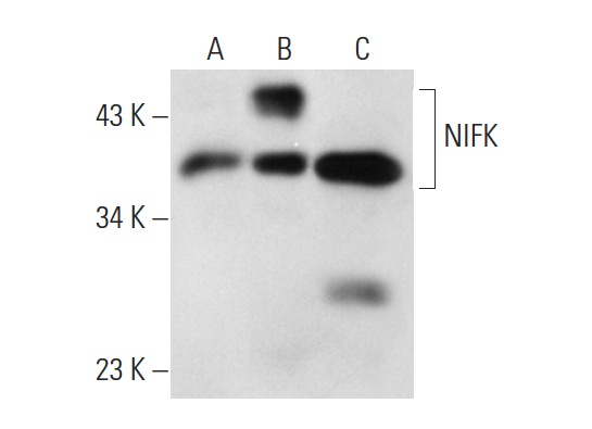  NIFK (18E148): sc-52904. Western blot analysis of NIFK expression in non-transfected 293T: sc-117752 (A), human NIFK transfected 293T: sc-170742 (B) and Ramos (C) whole cell lysates.